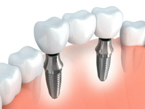 Dr. Carla Thomas, Inglewood, CA Dentist