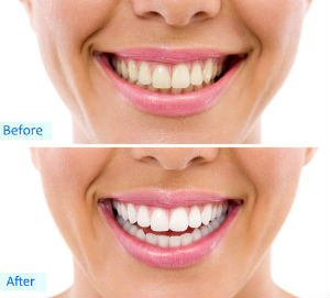 Dr. Thomas, Inglewood, CA Dentist