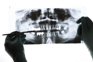 Dr. Thomas, Inglewood, CA Dentist